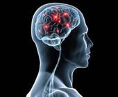 Akıl hastalığı beyninizi aşırı etkileyebilir