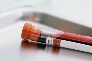 Son zamanlarda artan intihar riskini tahmin ettiği için bir kan testi müjdelendi, ancak basit bir kan testi ile gerçekten intihar riskini tahmin edebilir miyiz?